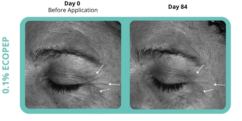 Clinical photos showing overall skin revitalisation and renewal with EcoPep 0.1% at Day 0 compared to Day 84, highlighting visible reduction in signs of ageing.