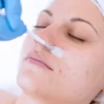 Revitalize Your Skin with Medical-Grade Chemical Peels: The Secret to Radiant Skin Health