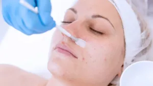 Revitalize Your Skin with Medical-Grade Chemical Peels: The Secret to Radiant Skin Health